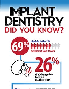 Implant Dentistry: Did you Know?