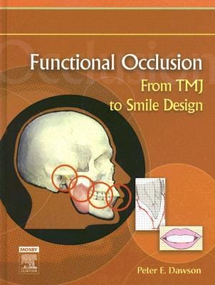 Functional Occlusion TMJ to Smile Design