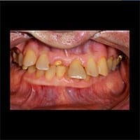 Complex Dental Case Study