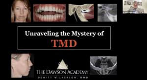 TMD Webinar The Dawson Academy