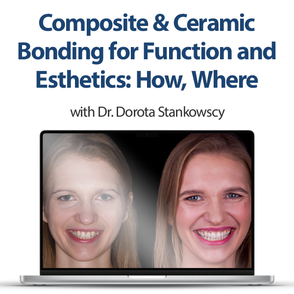 Composite & Ceramic Bonding for Function and Esthetics How, Where