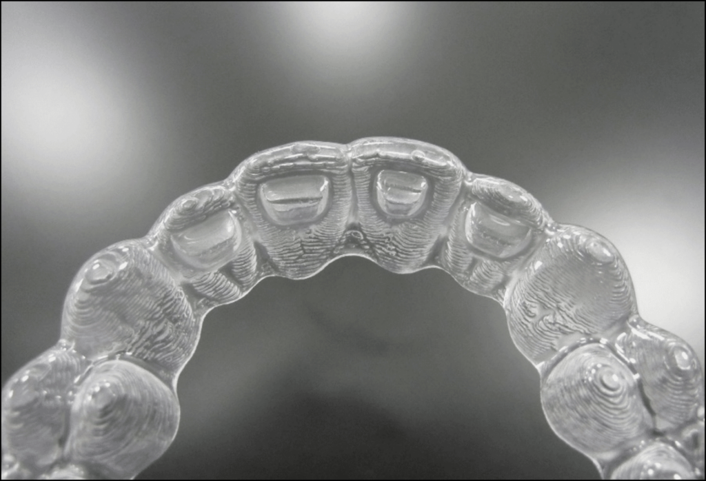 Image of invisalign clear aligners at Invisalign certification course at dawson academy