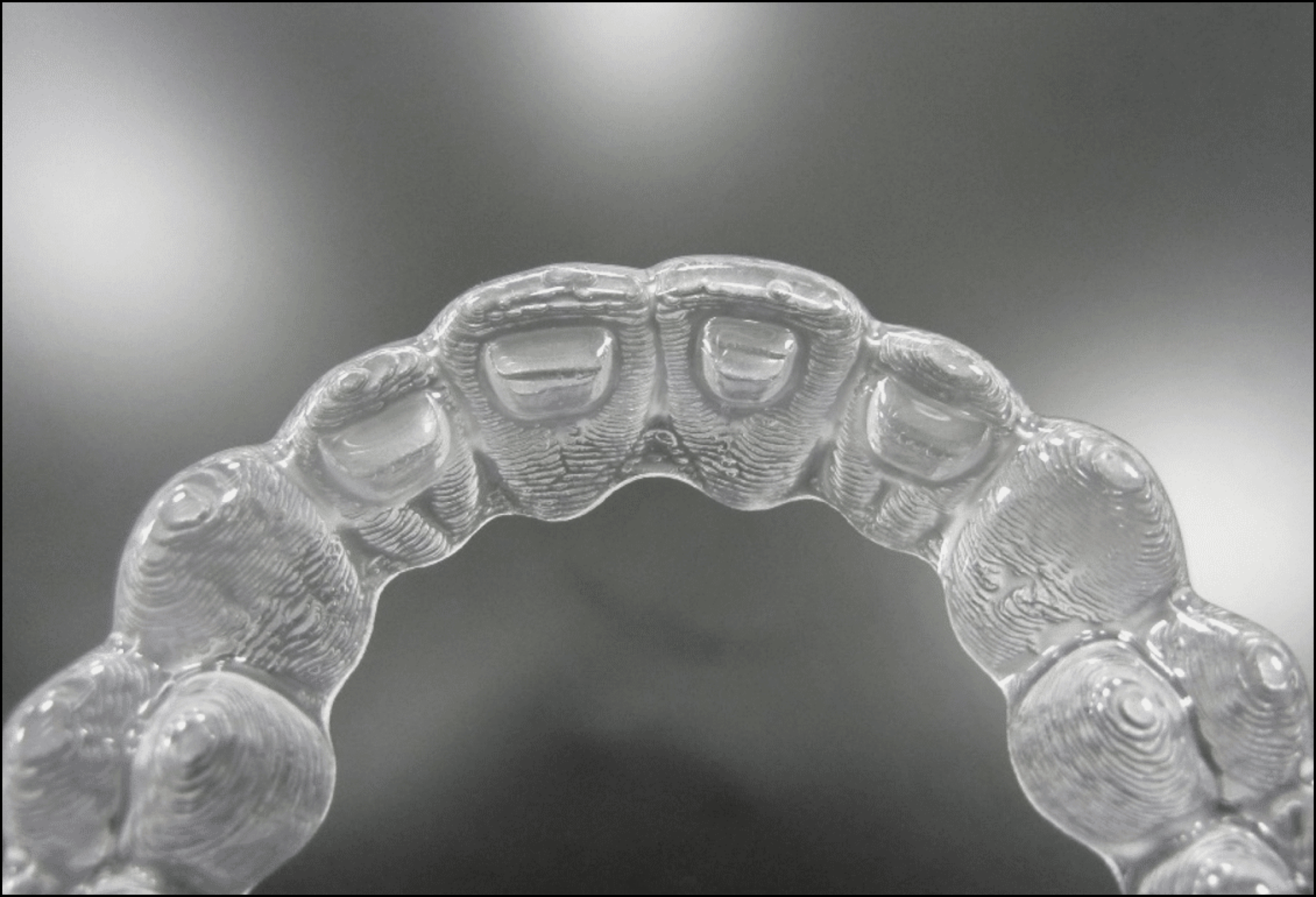 image of posterior view of Invisalign aligners, bite ramps are visible