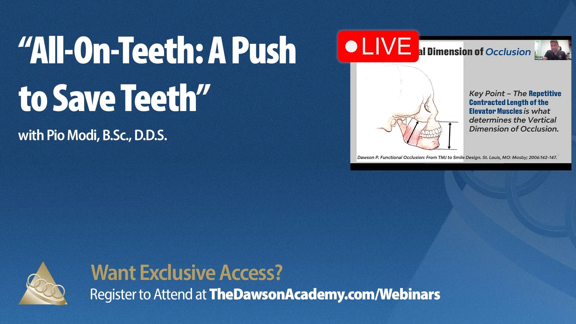 Thumbnail for Natural Teeth and Worn Dentition